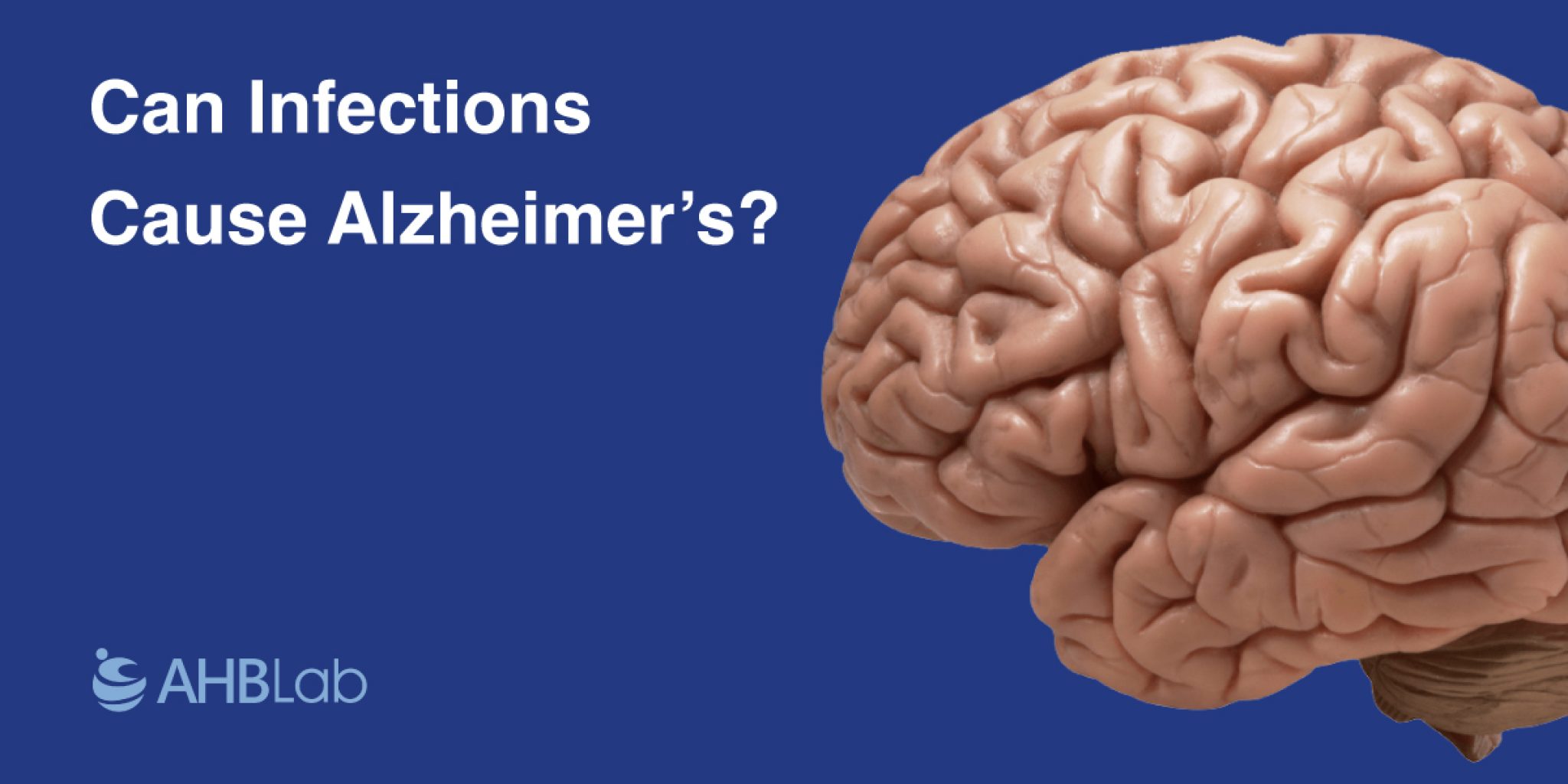 can infections cause alzheimers written on a blue background with brain image